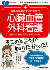 看護の現場ですぐに役立つ心臓血管外科看護 - 患者さんの経過に応じて手厚くサポート！ ナースのためのスキルアップノート