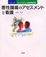 悪性腫瘍のアセスメントと看護 シリーズ／知っておきたい最新看護技術