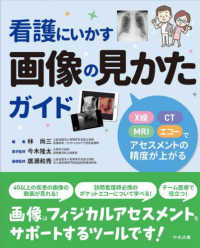 看護にいかす画像の見かたガイド - Ｘ線・ＣＴ・ＭＲＩ・エコーでアセスメントの精度が上