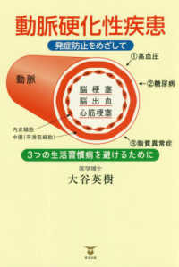 動脈硬化性疾患 - 発症防止をめざして