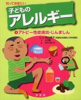 知っておきたい子どものアレルギー 〈１〉 アトピー性皮膚炎・じんましん 山口舞