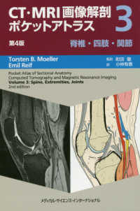 ＣＴ・ＭＲＩ画像解剖ポケットアトラス 〈３〉 脊椎・四肢・関節 （第４版）