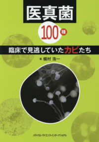 医真菌１００種　臨床で見逃していたカビたち