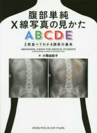 腹部単純Ｘ線写真の見かたＡＢＣＤＥ - ２枚並べてわかる読影の基本