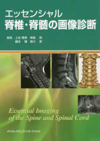 エッセンシャル脊椎・脊髄の画像診断