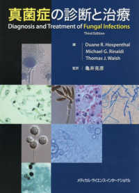 真菌症の診断と治療