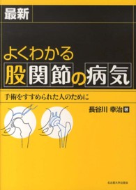 最新よくわかる股関節の病気 - 手術をすすめられた人のために