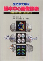 脳卒中の画像診断 - 見て診て学ぶ