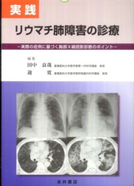 実践リウマチ肺障害の診療 - 実際の症例に基づく胸部Ｘ線読影診断のポイント