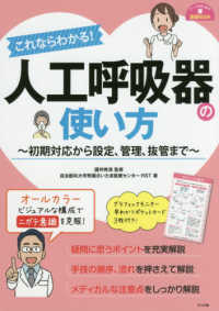 ナースのための基礎ＢＯＯＫ<br> これならわかる！人工呼吸器の使い方―初期対応から設定、管理、抜管まで