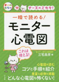 ナースのミカタ！<br> 一瞬で読める！モニター心電図