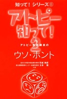 「アトピー」知って！ 〈２〉 知って！シリーズ