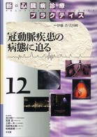 冠動脈疾患の病態に迫る 新・心臓病診療プラクティス