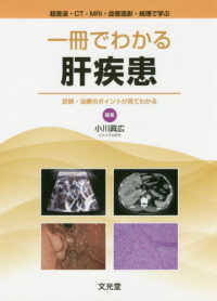 一冊でわかる肝疾患　診断・治療のポイントが見てわかる - 超音波・ＣＴ・ＭＲＩ・血管造影・病理で学ぶ