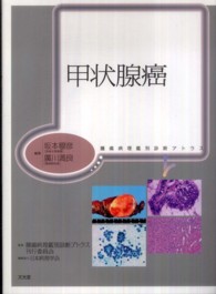 甲状腺癌 腫瘍病理鑑別診断アトラス