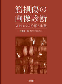 筋損傷の画像診断 - ＭＲＩによる分類と実践