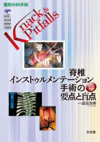 整形外科手術Ｋｎａｃｋ　＆　Ｐｉｔｆａｌｌｓ<br> 脊椎インストゥルメンテーション手術の要点と盲点