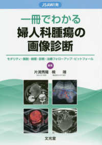 一冊でわかる婦人科腫瘍の画像診断 - ＪＳＡＷＩ発　モダリティ・解剖・病理・診断・治療フ