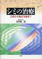 シミの治療 - このシミをどう治す？
