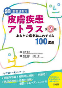 患者説明用皮膚疾患アトラス - あなたの病気はこれですよ１００疾患 （第２版）