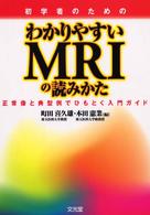 初学者のためのわかりやすいＭＲＩの読みかた - 正常像と典型例でひもとく入門ガイド