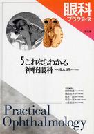 眼科プラクティス 〈５〉 これならわかる神経眼科