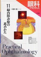 眼科プラクティス 〈１１〉 緑内障診療の進めかた