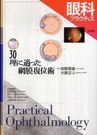 眼科プラクティス 〈３０〉 理に適った網膜復位術