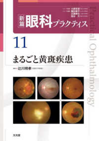 新篇眼科プラクティス<br> 新篇眼科プラクティス〈１１〉まるごと黄斑疾患