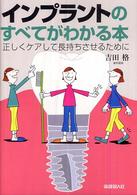 インプラントのすべてがわかる本 - 正しくケアして長持ちさせるために