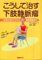 こうして治す下肢静脈瘤 - 日常生活のケアから最新情報まで