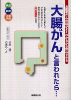 「大腸がん」と言われたら… - お医者さんの話がよくわかるから安心できる