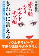 赤ら顔・シミ・ヤケド・キズ痕きれいに消える - 肌われ・ニキビ痕にも効果抜群の再生法