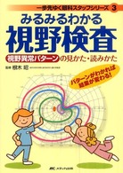 みるみるわかる視野検査 - 視野異常パターンの見かた・読みかた 一歩先ゆく眼科スタッフシリーズ