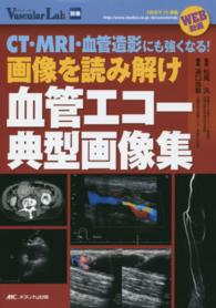 画像を読み解け血管エコー典型画像集 - ＣＴ・ＭＲＩ・血管造影にも強くなる！