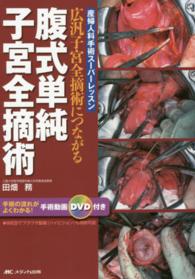 腹式単純子宮全摘術 - 広汎子宮全摘術につながる 産婦人科手術スーパーレッスン