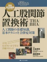 人工股関節置換術「ＴＨＡ　ＢＨＡ」 - 人工関節の基礎知識，基本テクニック，合併症対策 整形外科ＳＵＲＧＩＣＡＬ　ＴＥＣＨＮＩＱＵＥ　ＢＯＯＫＳ