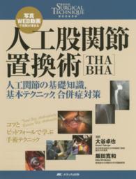 人工股関節置換術「ＴＨＡ　ＢＨＡ」 - 人工関節の基礎知識，基本テクニック，合併症対策 整形外科ＳＵＲＧＩＣＡＬ　ＴＥＣＨＮＩＱＵＥ　ＢＯＯＫＳ