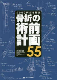 骨折の術前計画５５ - ７０００例から厳選