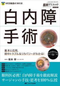 眼科グラフィック２０２２年増刊<br> 白内障手術 - 基本と応用，術中トラブル＆リカバリーがわかる！