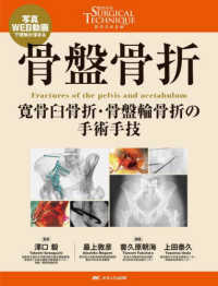 骨盤骨折 - 寛骨臼骨折・骨盤輪骨折の手術手技 整形外科ＳＵＲＧＩＣＡＬ　ＴＥＣＨＮＩＱＵＥ　ＢＯＯＫＳ