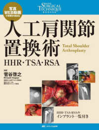 人工肩関節置換術 - ＨＨＲ・ＴＳＡ・ＲＳＡ 整形外科ＳＵＲＧＩＣＡＬ　ＴＥＣＨＮＩＱＵＥ　ＢＯＯＫＳ