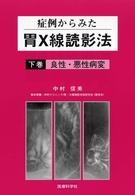 症例からみた胃Ｘ線読影法 〈下巻〉 良性・悪性病変