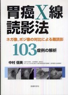 胃癌Ｘ線読影法 - ネガ像，ポジ像の対比による難読影１０３症例の解析