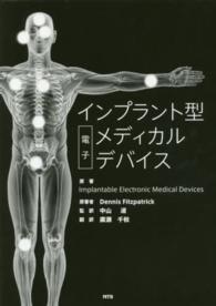 インプラント型電子メディカルデバイス