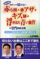 改訂版　医師による切らない赤ら顔・赤アザ・キズ跡・浮き出た青い血管の専門最新治療―あなたの深刻な悩みを最新治療で解決する （改訂版）