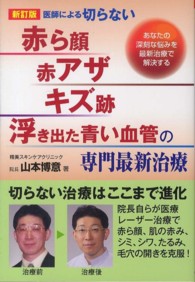 医師による切らない「赤ら顔・赤アザ・キズ跡・浮き出た青い血管」の専門最新治療 - あなたの深刻な悩みを最新治療で解決する （新訂版）
