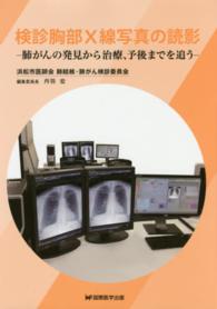 検診胸部Ｘ線写真の読影 - 肺がんの発見から治療、予後までを追う