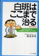 白斑はここまで治る―白斑先生が書いた「光線療法」の基本がわかる本 （改訂新版）