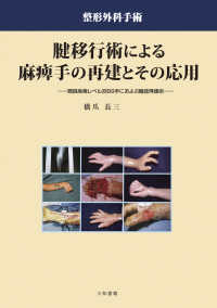 腱移行術による麻痺手の再建とその応用 - 頸損麻痺レベル別９９手におよぶ機能再建術